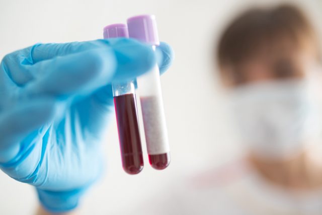 Novel Chinese Coronavirus blood test Concept. Nurse holding test tube with blood for 2019-nCoV analyzing.