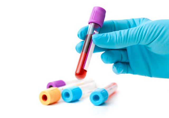 hand in protective glove holding a blood sample